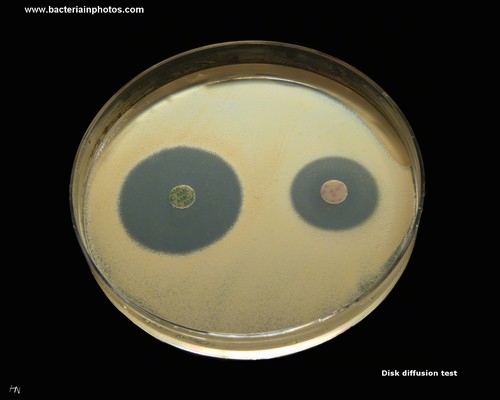 antibiotic susceptible bacterium